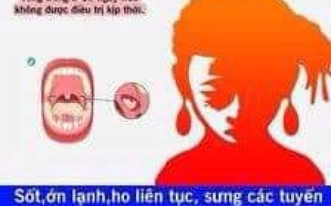 Phòng chống bệnh bạch hầu