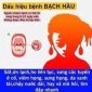 Phòng chống bệnh bạch hầu